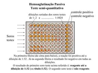 Hemoaglutinação Passiva Teste semi-quantitativo Soros testes controle positivo controle negativo diluições seriadas dos soros testes de 1: 2  a  ..................  1:1024  Na primeira fileira (de cima para baixo), a reação foi positiva até a diluição de 1:32 . Já na segunda fileira o resultado foi negativo em todas as diluições. O resultado do primeiro soro teste acima referido é:  reagente até a  diluição de 1:32  (ou  título:1:32 ). O segundo soro teste é  não reagente . 