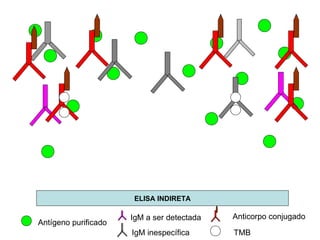 ELISA INDIRETA Antígeno purificado IgM a ser detectada IgM inespecífica Anticorpo conjugado TMB 