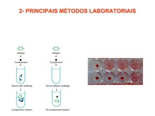 2- PRINCIPAIS MÉTODOS LABORATORIAIS 2.4- Fixação do Complemento: 