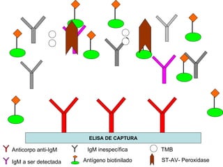 ELISA DE CAPTURA Anticorpo anti-IgM IgM a ser detectada IgM inespecífica Antígeno biotinilado TMB ST-AV- Peroxidase 