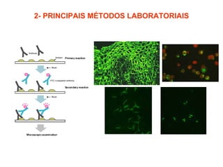 2- PRINCIPAIS MÉTODOS LABORATORIAIS 2.6- Imunofluorescência / Imunohistoquímica: 