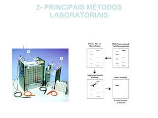 2- PRINCIPAIS MÉTODOS LABORATORIAIS 2.7- Western-Blot: 