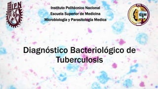 Diagnóstico Bacteriológico de
Tuberculosis
Instituto Politécnico Nacional
Escuela Superior de Medicina
Microbiología y Parasitología Medica
 