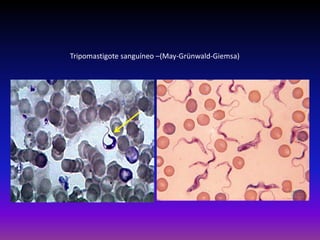 Tripomastigote sanguíneo –(May-Grünwald-Giemsa)
 
