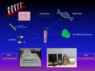 primers
Taq DNA-polimerasa
F
R
ADN totalextracción
PCR
convencional
PCR
En Tiempo Real
nucleótidos
dATP, dGTP, dCTP, dTTP
 