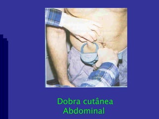 Dobra cutânea Abdominal  