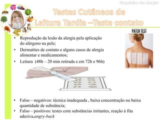• Reprodução da lesão da alergia pela aplicação
do alérgeno na pele;
• Dermatites de contato e alguns casos de alergia
alimentar e medicamentos;
• Leitura (48h – 20 min retirada e em 72h e 96h)
• Falso – negativos: técnica inadequada , baixa concentração ou baixa
quantidade de substância;
• Falso – positivos: testes com substâncias irritantes, reação à fita
adesiva,angry-back
 