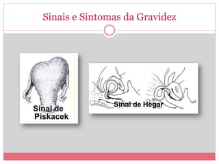 Diagnóstico de Gravidez na Atenção Básica | PPTX