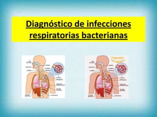 Diagnóstico de infecciones
respiratorias bacterianas

 
