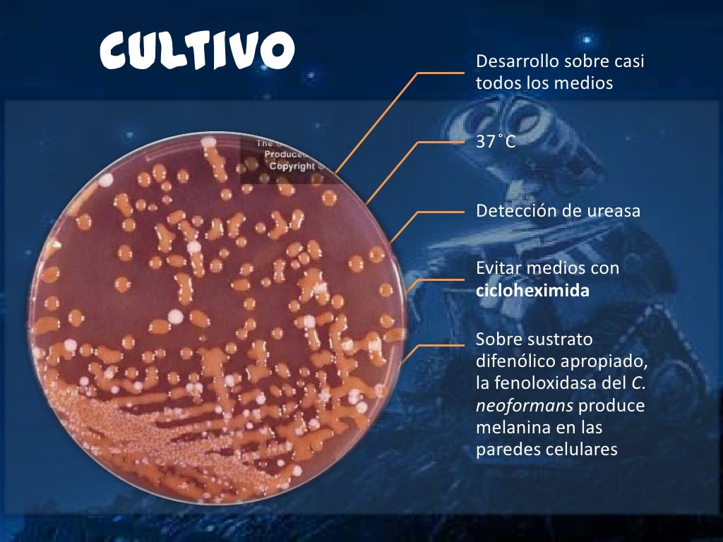 Cryptococcus neoformans