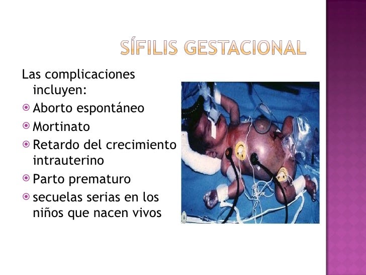 Diagn stico De S filis