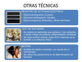 OTRAS TÉCNICAS