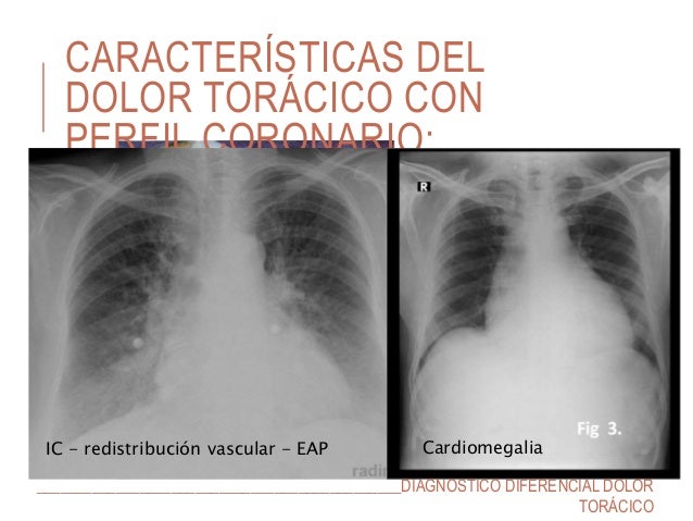 Los ejercicios a la osteocondrosis de la cadera del vídeo