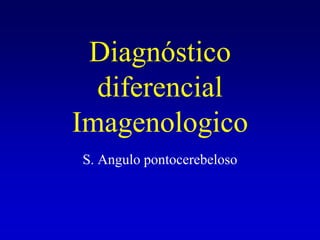 Diagnóstico diferencial Imagenologico S. Angulo pontocerebeloso 