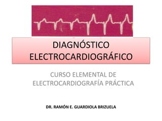 DIAGNÓSTICO
ELECTROCARDIOGRÁFICO
CURSO ELEMENTAL DE
ELECTROCARDIOGRAFÍA PRÁCTICA
DR. RAMÓN E. GUARDIOLA BRIZUELA
 