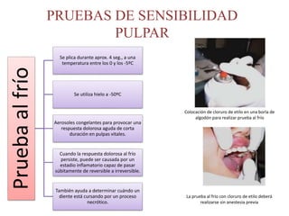 Diagnóstico endodóntico | PPTX