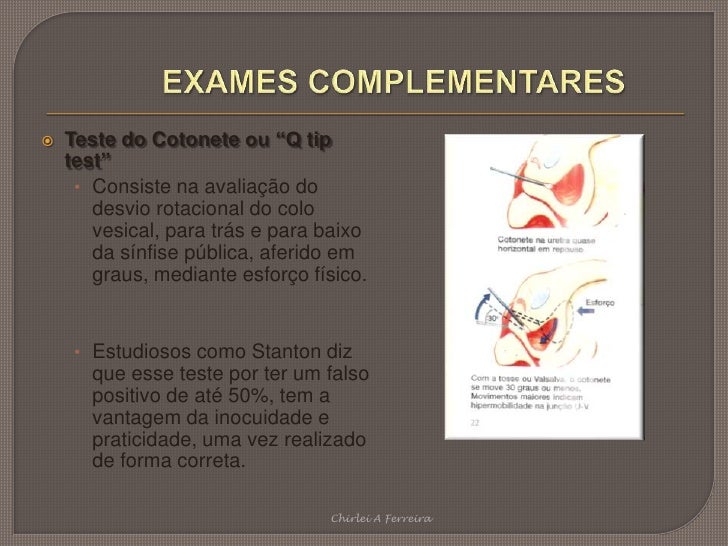 Exames pelvicos