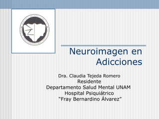 Neuroimagen en
Adicciones
Dra. Claudia Tejeda Romero
Residente
Departamento Salud Mental UNAM
Hospital Psiquiátrico
“Fray Bernardino Álvarez”
 