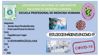 UNIVERSIDAD NACIONAL DE SAN MARTÍN
FACULTAD DE MEDICINA HUMANA
ESCUELA PROFESIONAL DE MEDICINA HUMANA
ESTUDIODEIMÁGENESENCOVID-19
Integrantes
• JhordanAlexisParedesBernales
• FranzLouisPortocarreroAlarcón
Curso
• Diagnósticoporimagen
Docente
• Dr.HÉCTORMARTÍN NÚÑEZ DELACRUZ
Ciclo
• VI
AÑO
• 2022
 