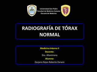 RADIOGRAFÍA DE TÓRAX
      NORMAL

         Medicina Interna II
              Docente:
          Dra. Altamirano
              Alumno:
    Quijano Rojas Roberto Darwin
 