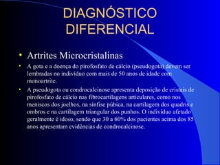 DIAGNÓSTICO
DIFERENCIAL
• Artrites Microcristalinas
• A gota e a doença do pirofosfato de cálcio (pseudogota) devem ser
lembradas no indivíduo com mais de 50 anos de idade com
monoartrite.
• A pseudogota ou condrocalcinose apresenta deposição de cristais de
pirofosfato de cálcio nas fibrocartilagens articulares, como nos
meniscos dos joelhos, na sínfise púbica, na cartilagem dos quadris e
ombros e na cartilagem triangular dos punhos. O indivíduo afetado
geralmente é idoso, sendo que 30 a 60% dos pacientes acima dos 85
anos apresentam evidências de condrocalcinose.
 