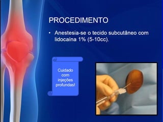 Diagnósticos diferenciais das monoartrites.