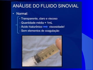 Diagnósticos diferenciais das monoartrites.