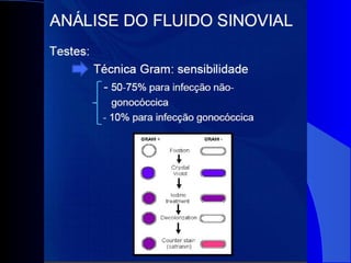 Diagnósticos diferenciais das monoartrites.