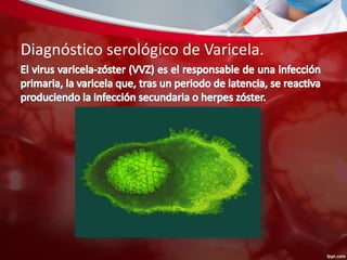 Diagnóstico serológico de Varicela. 
 