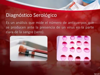 Diagnóstico Serológico 
Es un análisis que mide el número de anticuerpos que 
se producen ante la presencia de un virus en la parte 
clara de la sangre (sero). 
 