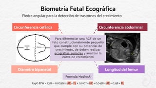 Comprehensive Overview of Fetal Growth Restriction in Obstetrics | PDF