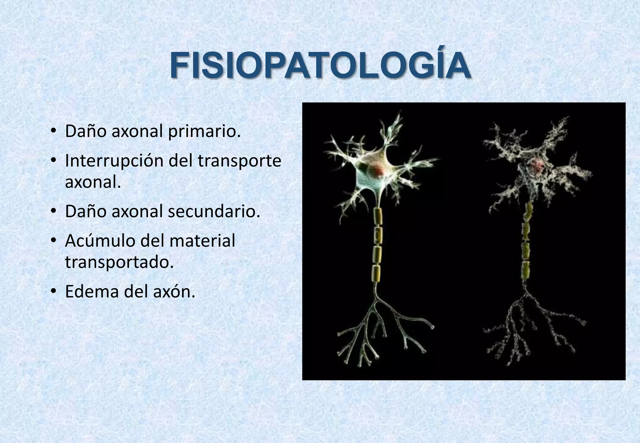 Daño axonal difuso secundario a traumatismo craneoencefálico | PPTX
