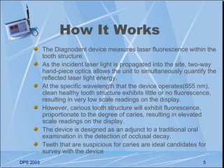 How It Works
           The Diagnodent device measures laser fluorescence within the
           tooth structure.
           As the incident laser light is propagated into the site, two-way
           hand-piece optics allows the unit to simultaneously quantify the
           reflected laser light energy.
           At the specific wavelength that the device operates(655 nm),
           clean healthy tooth structure exhibits little or no fluorescence,
           resulting in very low scale readings on the display.
           However, carious tooth structure will exhibit fluorescence,
           proportionate to the degree of caries, resulting in elevated
           scale readings on the display.
           The device is designed as an adjunct to a traditional oral
           examination in the detection of occlusal decay.
           Teeth that are suspicious for caries are ideal candidates for
           survey with the device
DPS 2003                                                               5
 