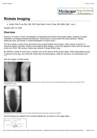 Rickets Imaging                                                                                                                   01-05-11 22:34




 Rickets Imaging
          Author: Rick R van Rijn, MD, PhD; Chief Editor: Felix S Chew, MD, MBA, EdM more...

 Updated: Mar 18, 2009

 Overview
 Rickets is an entity in which mineralization is decreased at the level of the growth plates, resulting in growth
 retardation and delayed skeletal development. Osteomalacia is found within the same spectrum, affects
 trabecular bone, and results in undermineralization of osteoid bone.

 The term rickets is said to have derived from the ancient English word wricken, which means "to bend." In
 several European countries, rickets is also called English disease, a term that appears to stem from the fact that
 at the turn of the 19th century, rickets was endemic in larger British cities.

 By definition, rickets is found only in children prior to the closure of the growth plates, while osteomalacia occurs
 in persons of any age. Any child with rickets also has osteomalacia, while the reverse is not necessarily true. [1,
 2, 3]

 See the images of rickets below.




 Anteroposterior and lateral radiographs of the wrist of an 8-year-old boy with rickets demonstrates cupping and fraying of the
 metaphyseal region.




 Radiograph in a 4-year-old girl with rickets depicts bowing of the legs caused by loading.

 Clinical findings are related to the involved skeletal site, as shown in the image below.




http://emedicine.medscape.com/article/412862-overview?newEmailA…rez%40gmail.com&submitemailupdate=Update+Email+Address#showall      Página 1 de 4
 
