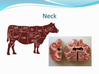 Neck
 