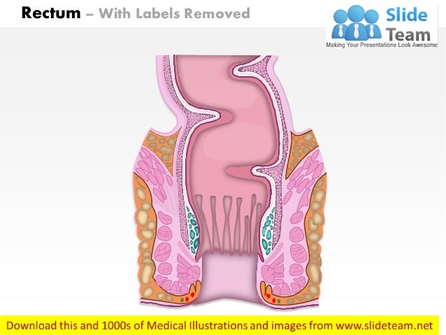 Urectum Rectum Diagram 0614 Diagram Of Rectum Medical Images For PowerPoint