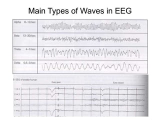 Main Types of Waves in EEG
 