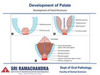Development of Palate
Dept of Oral Pathology
Faculty of Dental Sciences
Development of Facial Structures
 