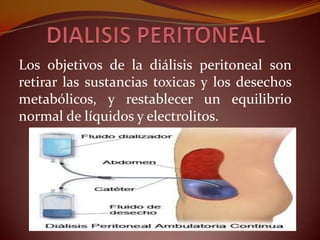 Los objetivos de la diálisis peritoneal son
retirar las sustancias toxicas y los desechos
metabólicos, y restablecer un equilibrio
normal de líquidos y electrolitos.
 