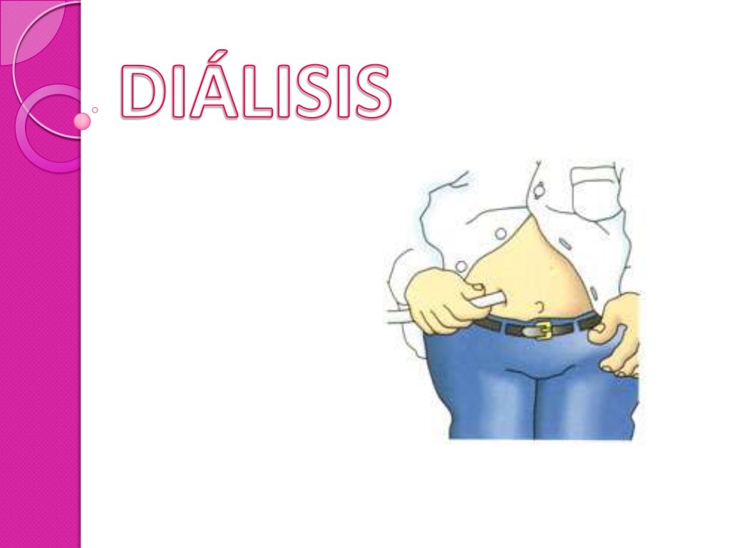 Dialisis