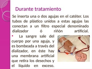 Durante tratamiento
Se inserta una o dos agujas en el catéter. Los
tubos de plástico unidos a estas agujas las
conectan a un filtro especial denominado
dializador ó riñón artificial.
• La sangre sale del
cuerpo por una aguja, y
es bombeada a través del
dializador, en éste hay
una membrana artificial
que retira los desechos y
el líquido en exceso.
 