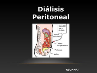 Diálisis
Peritoneal
ALUMNA:
 