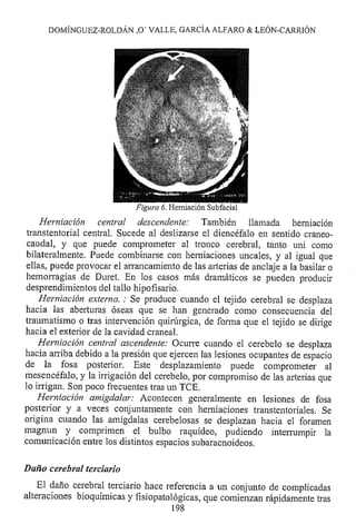 Lesión cerebral traumatica
