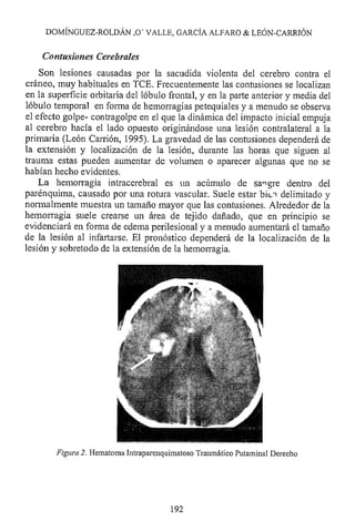 Lesión cerebral traumatica