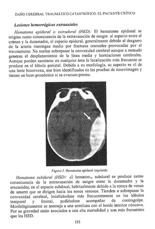 Lesión cerebral traumatica