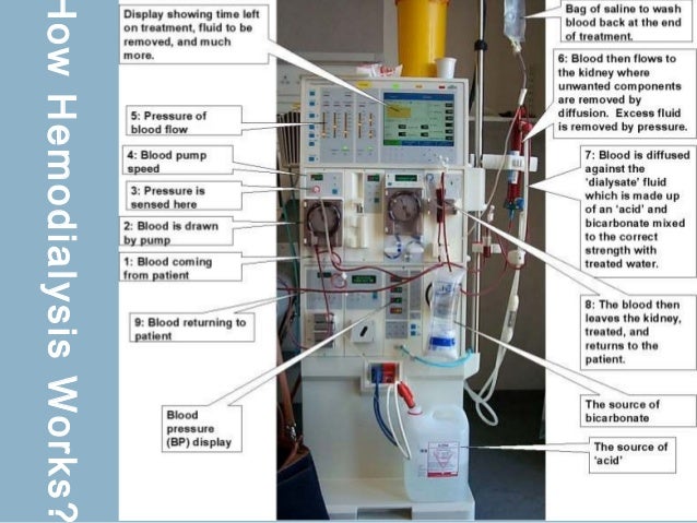 dialysis how hemodialysis works