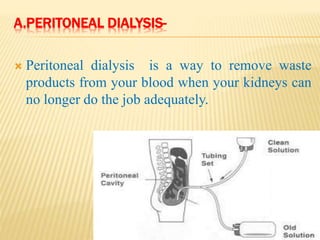A.PERITONEAL DIALYSIS-
 Peritoneal dialysis is a way to remove waste
products from your blood when your kidneys can
no longer do the job adequately.
 