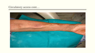 Circulatory access cont…
 