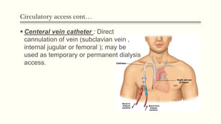Circulatory access cont…
 Centeral vein catheter : Direct
cannulation of vein (subclavian vein ,
internal jugular or femoral ); may be
used as temporary or permanent dialysis
access.
 
