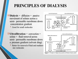 Dialysis. basic description for PG students | PPTX